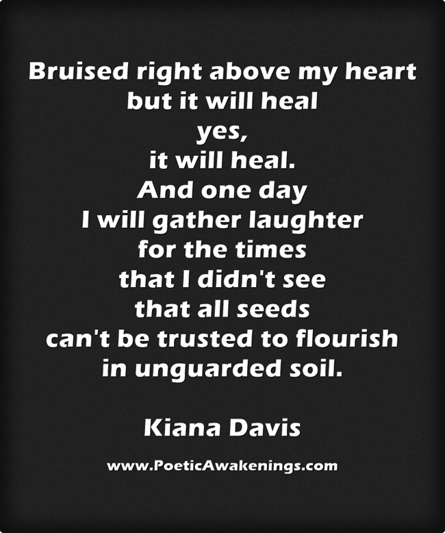 bruised-right-above-my